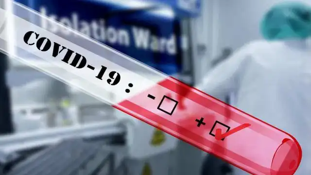 Статистика случаев COVID-19 в Алматы является показателем интенсивной работы по тестированию широкого контингента лиц